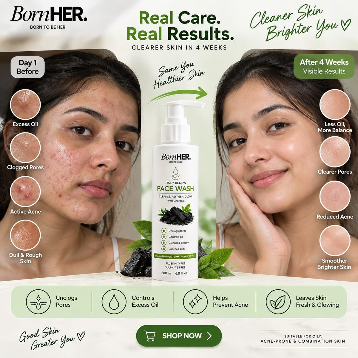 BornHER Daily Renew Charcoal Face Wash with Salicylic Acid, PHA & Zinc PCA – 200 ml